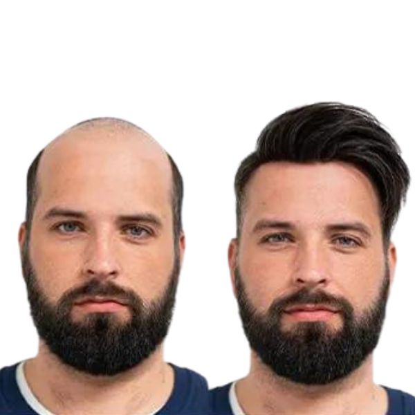 Peruca Masculina Completa